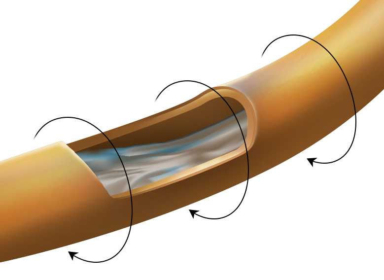 copper Prapatsorn Medical เครื่องมือกายภาพบำบัด และตรวจปอด