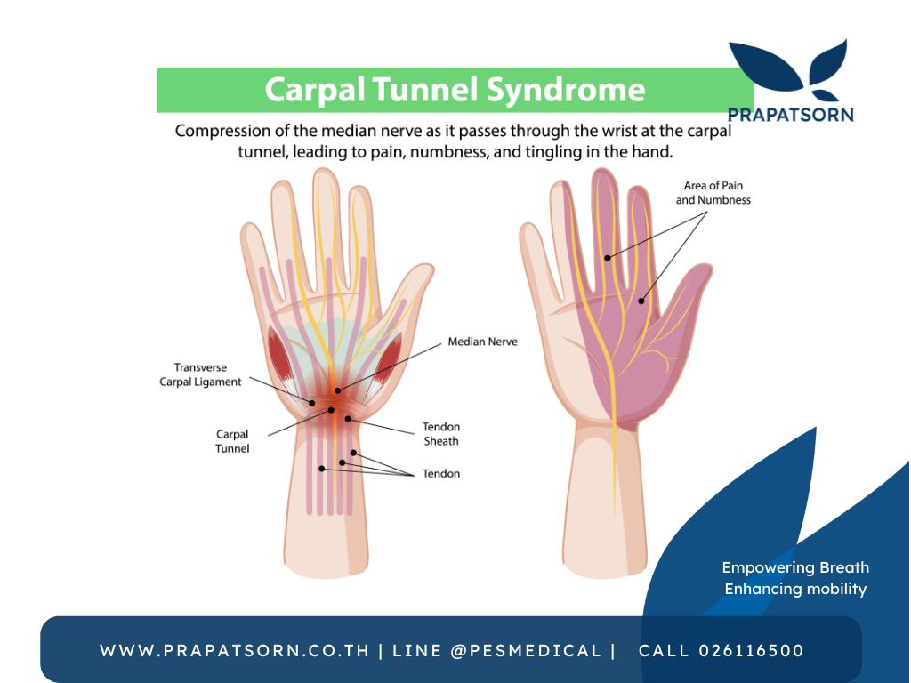 ดีไซน์ที่ยังไม่ได้ตั้งชื่อ 1 Prapatsorn Medical เครื่องมือกายภาพบำบัด และตรวจปอด