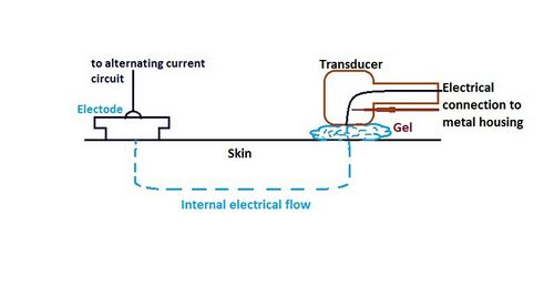 491px Combination therapy schematic Prapatsorn Medical เครื่องมือกายภาพบำบัด และตรวจปอด