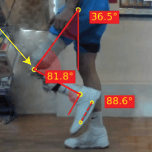Excessive-knee-flexion