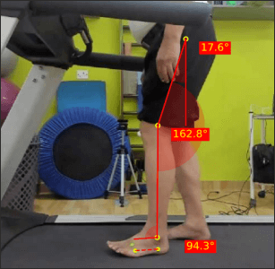 Left initial contact Parkinsons 1 Prapatsorn Medical เครื่องมือกายภาพบำบัด และตรวจปอด