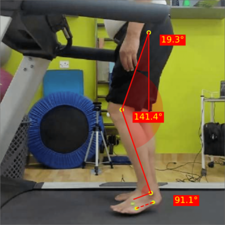 Left-initial-swing_Parkinsons-1