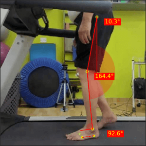 Left loading response Parkinsons 1 Prapatsorn Medical เครื่องมือกายภาพบำบัด และตรวจปอด