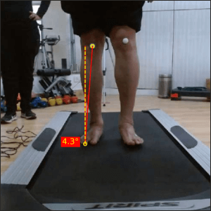 Left mid stance Ant Parkinsons 4 Prapatsorn Medical เครื่องมือกายภาพบำบัด และตรวจปอด