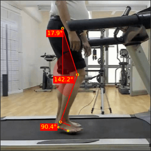 Right-initial-swing_Parkinsons-2