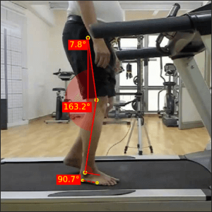 Right-loading-response_Parkinsons-2