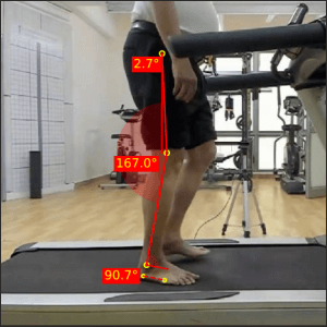 Right-mid-stance_Parkinsons-2