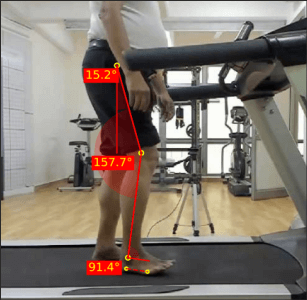 Right-mid-swing_Parkinsons-2