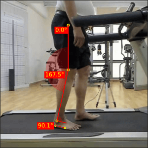 Right-terminal-stance_Parkinsons-2