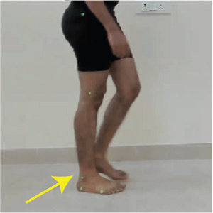 Stance -Phase-1
