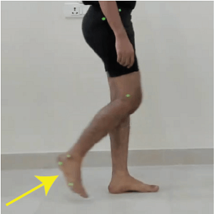 Stance Phase 2 Prapatsorn Medical เครื่องมือกายภาพบำบัด และตรวจปอด