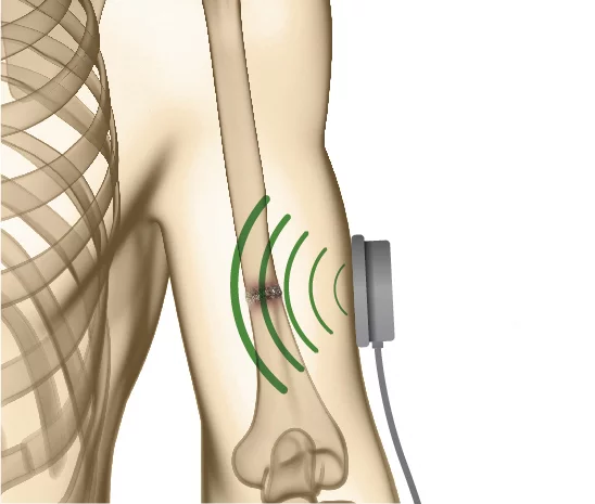 Terapia LIPUS Prapatsorn Medical เครื่องมือกายภาพบำบัด และตรวจปอด