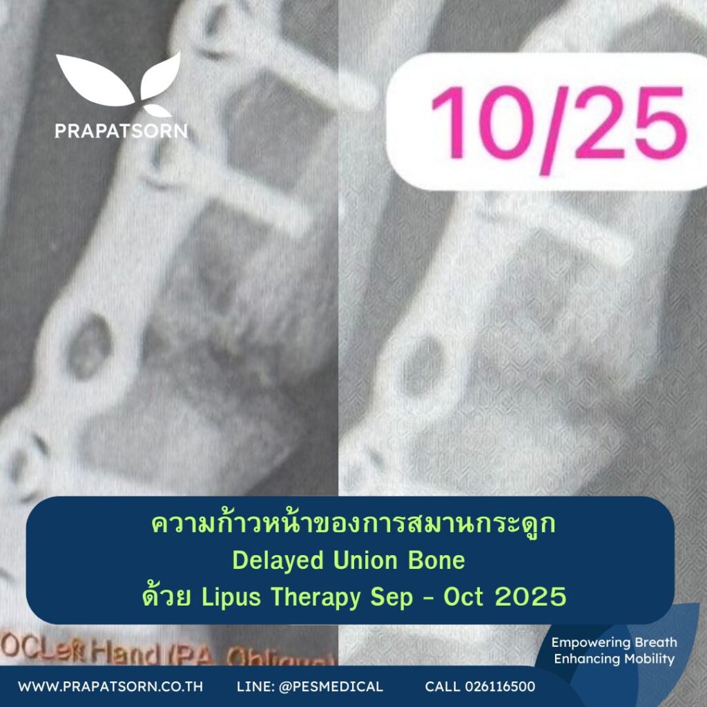 Physio Education 26 Prapatsorn Medical เครื่องมือกายภาพบำบัด และตรวจปอด