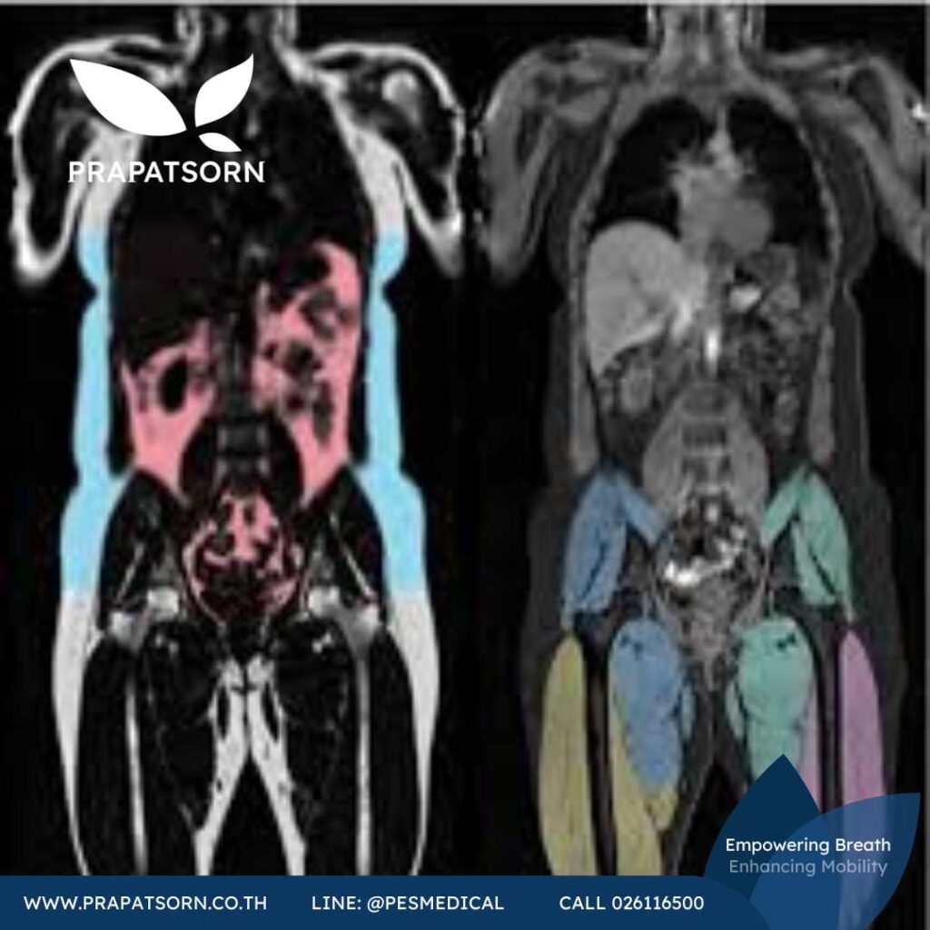 MRI Scan Prapatsorn Medical เครื่องมือกายภาพบำบัด และตรวจปอด