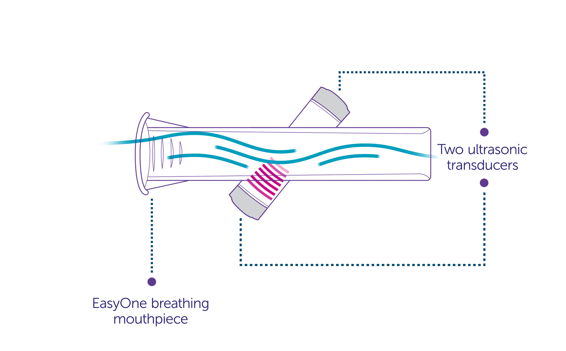 trueflow sensor labels 18358612497306459111 hu 4085c15b7caa5fe9 Prapatsorn Medical เครื่องมือกายภาพบำบัด และตรวจสมรรถภาพปอด